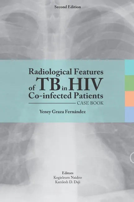 Radiological features of TB in HIV Co-infected Patients. Case book - Paperback