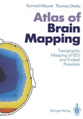 Atlas of Brain Mapping: Topographic Mapping of Eeg and Evoked Potentials - Paperback