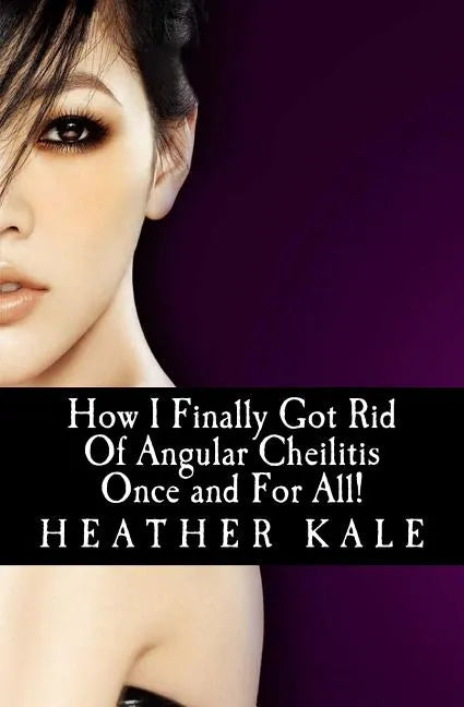 How I Finally Got Rid Of Angular Cheilitis Once and For All!: Cracked Mouth Corners No More - Paperback