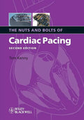 Nuts Bolts Cardiac Pacing 2e - Paperback