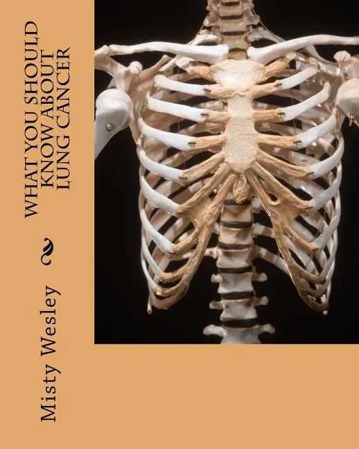 What you should know about Lung Cancer - Paperback