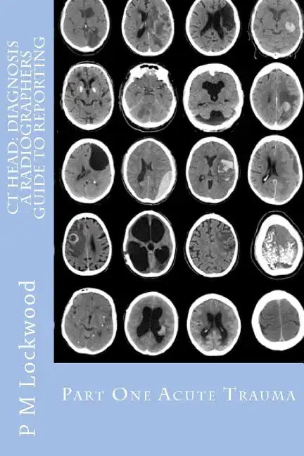 CT Head: DIAGNOSIS A Radiographers Guide To Reporting Part 1 Acute Trauma: Part One Acute Trauma - Paperback