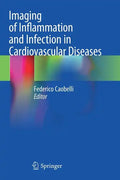 Imaging of Inflammation and Infection in Cardiovascular Diseases - Paperback
