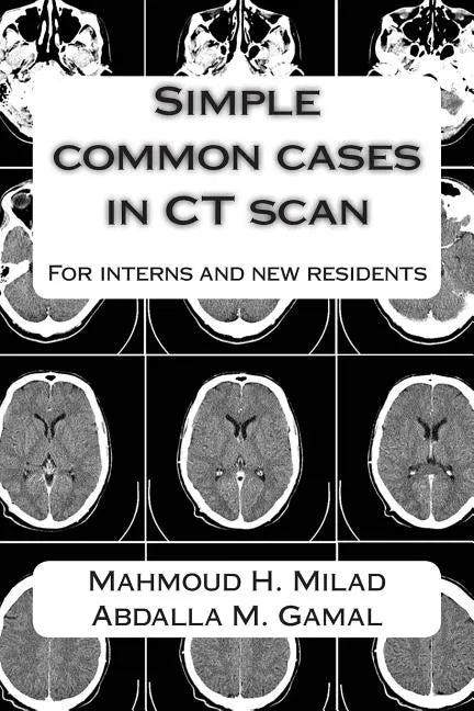 Simple common cases in CT scan: For interns and new residents - Paperback