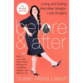 Before & After, Second Revised Edition: Living and Eating Well After Weight-Loss Surgery - Paperback