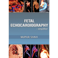 Fetal Echocardiography - Simplified - Paperback