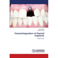 Osseointegration of Dental Implants - Paperback