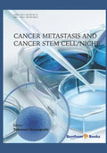 Cancer Metastasis and Cancer Stem Cell/Niche - Paperback