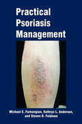 Practical Psoriasis Management - Paperback